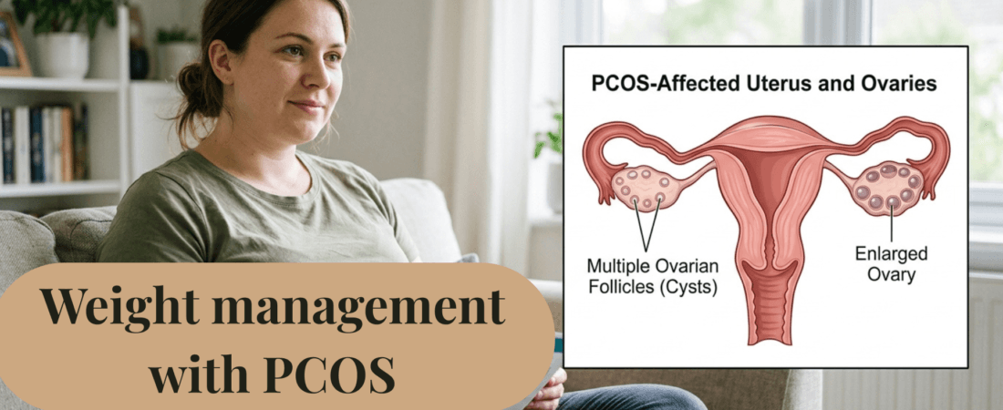 Weight Loss for PCOS: What Actually Works and Why It’s So Hard